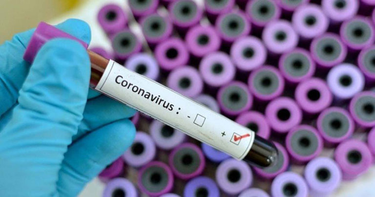 Madrid realizará 11.000 test a Policías Locales y profesionales de emergencias